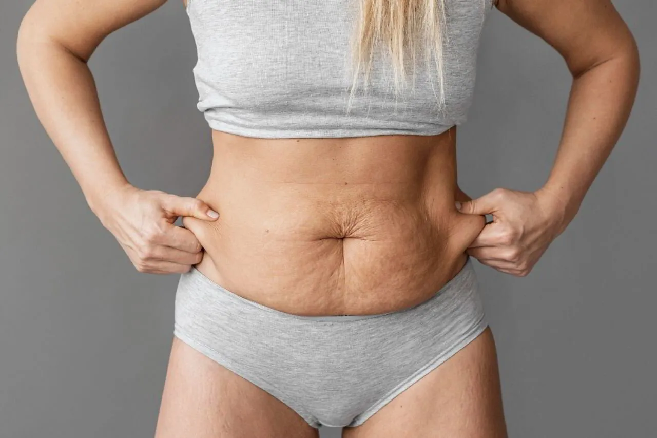Losing Belly Fat